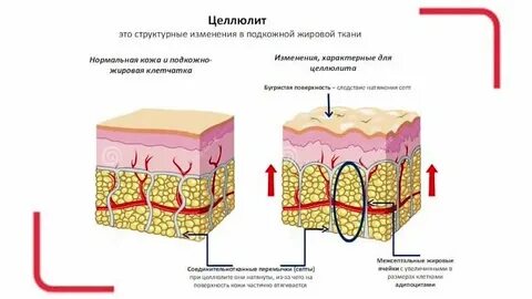 Подкожно жировая клетчатка выражена