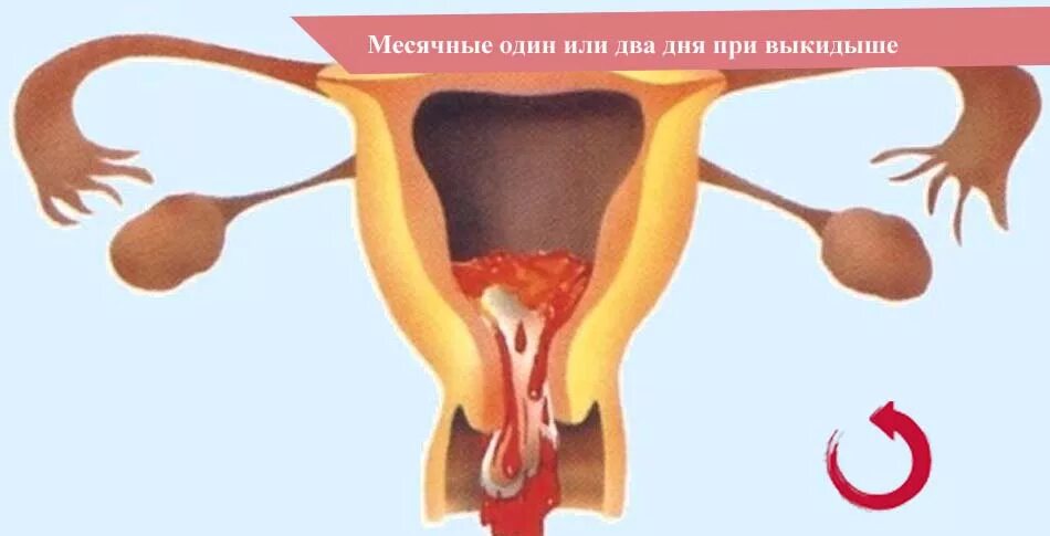 Менструация два дня бывает. Спорт после месячных