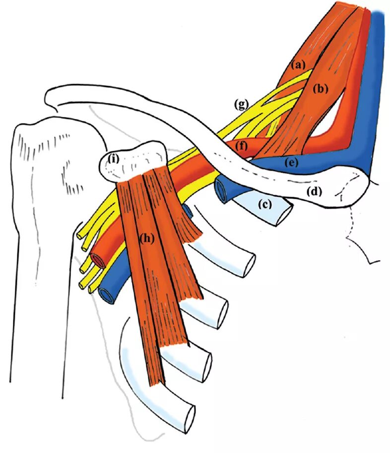 Блокада сплетения. Межлестничная блокада плечевого сплетения. Блокада плечевого сплетения анатомия. Межлестничный промежуток плечевое сплетение. Блокада плечевого сплетения топографическая анатомия.