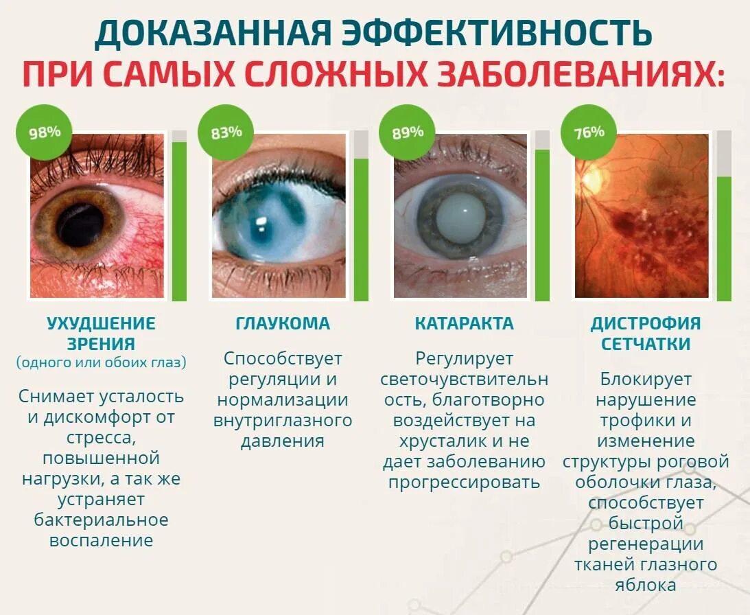 При глаукоме можно применять. Нарушение зрения катаракта. Глаза больных глаукомой. Процесс ухудшения зрения. Заболевание хрусталика и глаукомы.