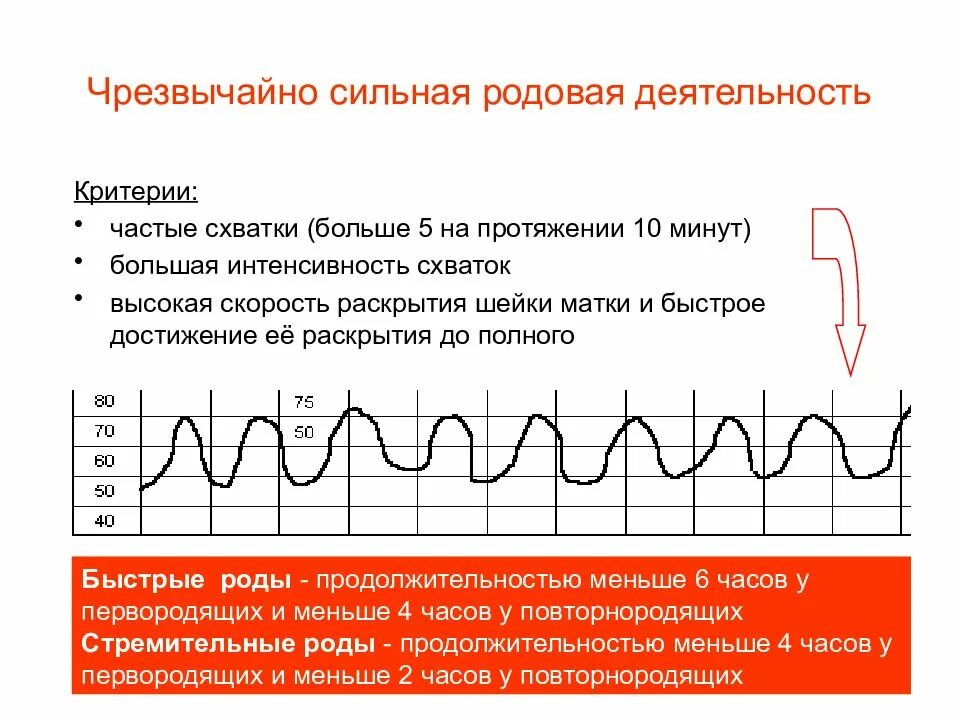 Чрезвычайно сильная родовая деятельность. Роды родовая деятельность. Динамика родовой деятельности это. Схватки родовой деятельности. Каждые 5 минут схватки через сколько роды