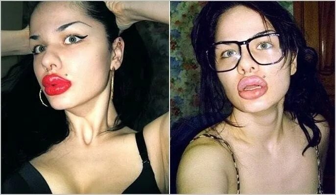 Увеличенные губы большие. Очень большие накаченные губы. Аккуратные накаченные губы. Губы маленькие уточкой. Кристина рэй сейчас 2021.