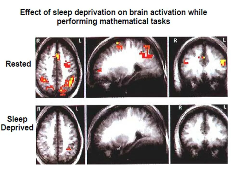 Sleeping brains