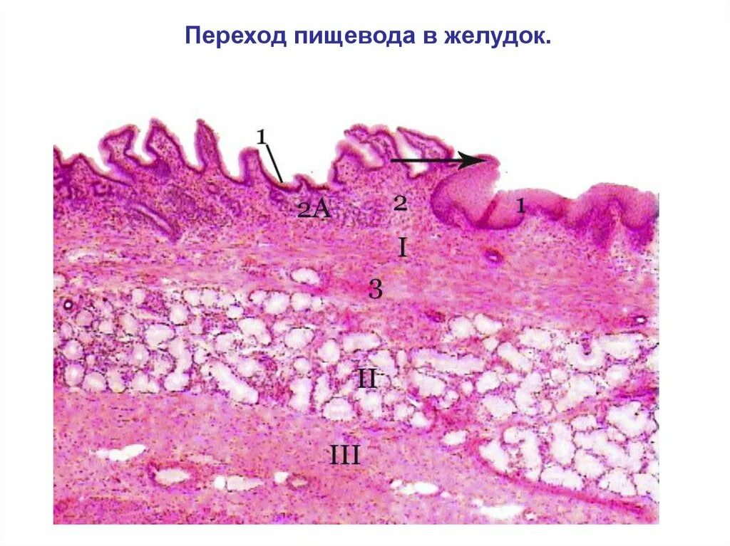 Переход пищевода в желудок препарат гистология. Место перехода пищевода в желудок гистология. Срез желудка гистология. Слизистая желудка гистология.