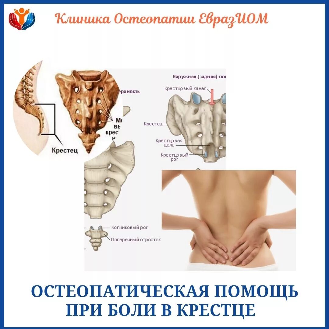 ягодицы и крестец анатомия. воспаление копчика кокцигодиния. межпозвоночные грыжи в крестце. пояснично-крестцовый отдел позвоночника. крестец у человека.