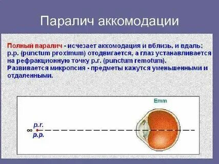 Спазм аккомодации код мкб 10 у детей