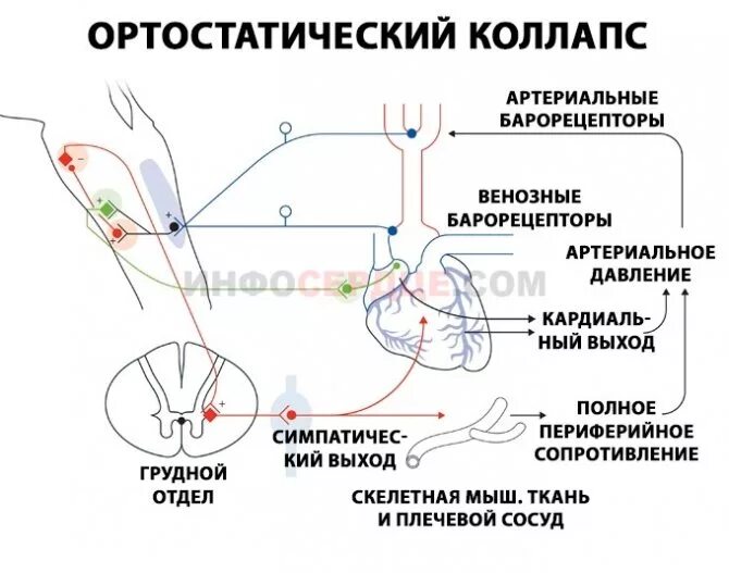Ортостатический коллапс помощь. Механизм развития ортостатической гипотензии. ортостатический коллапс патогенез. ортостатический коллапс механизм развития. ортостатическая гипотензия патогенез.