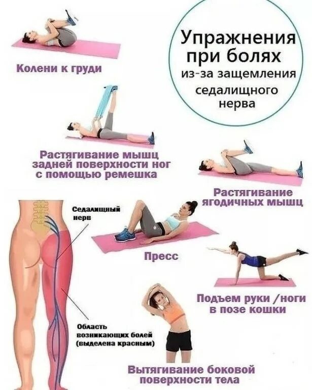 упражнения при ущемлении седалищного. гимнастмка при защемление седалищного нер. защемление седалищного нерва лфк. упражнения при защемлении нерва. защемление седалищного нерва лфк упражнения.