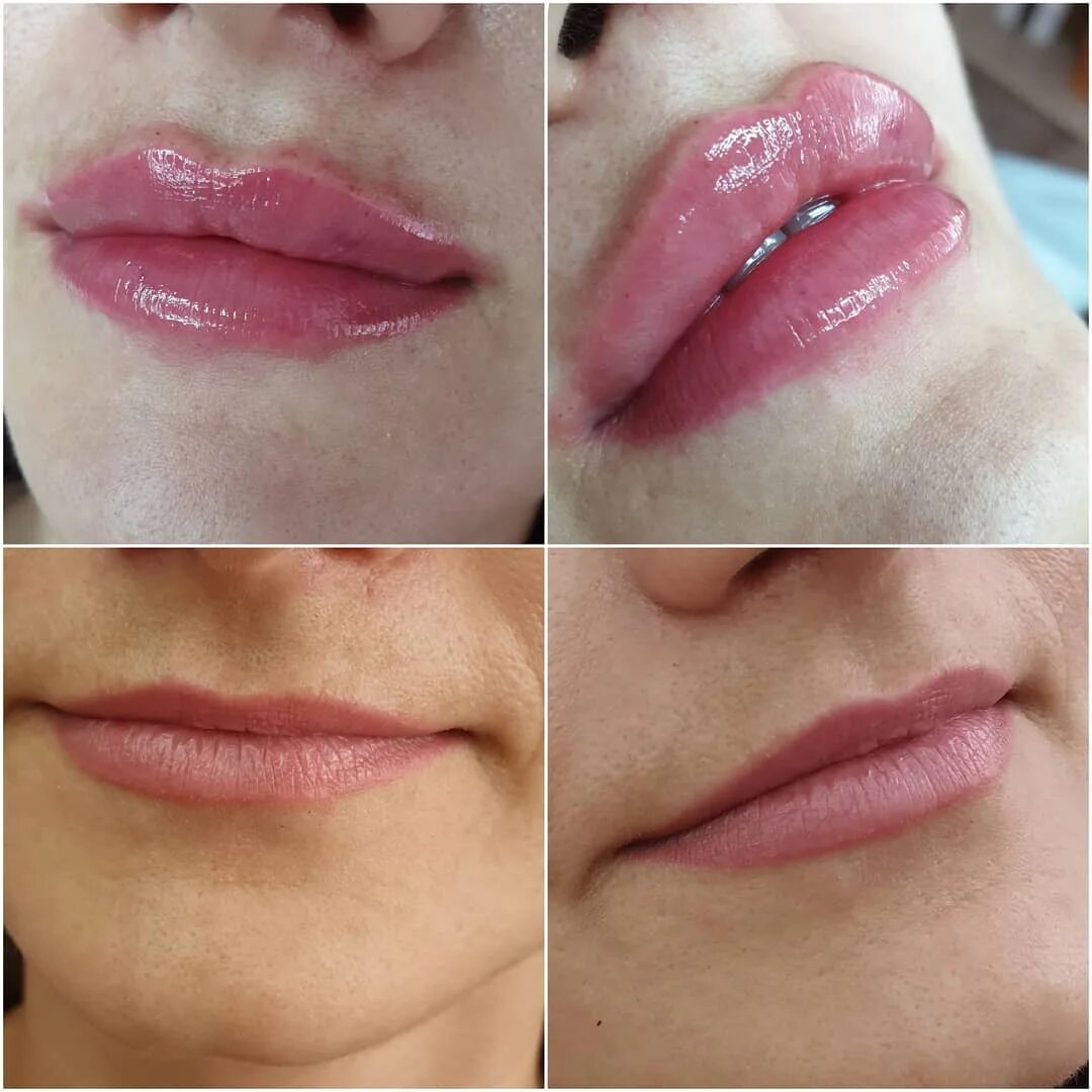 Техника увеличения губ бантиком. Увеличенные губы красивые. Формы увеличенных губ. Техник увеличения губ. Техник увеличения губ.