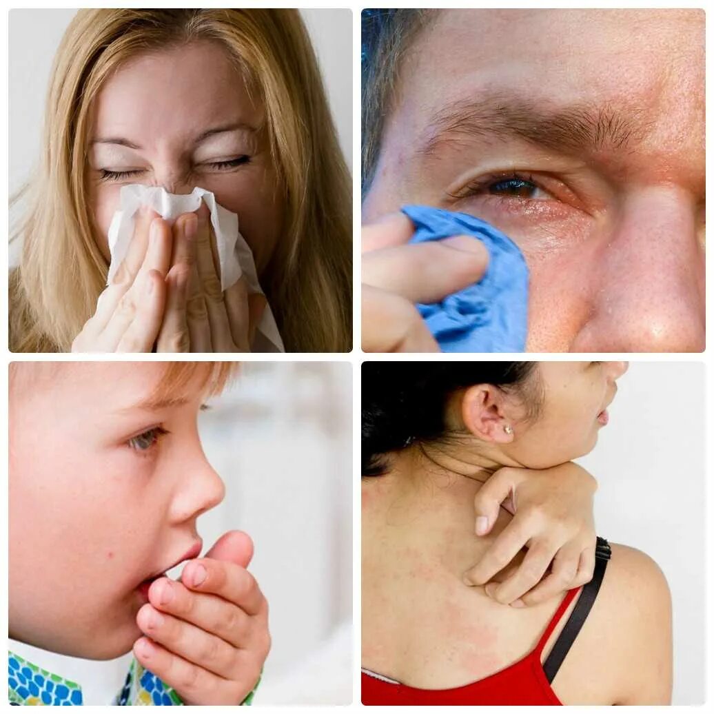 Человек страдающий аллергией. Аллергия на пыль симптомы.