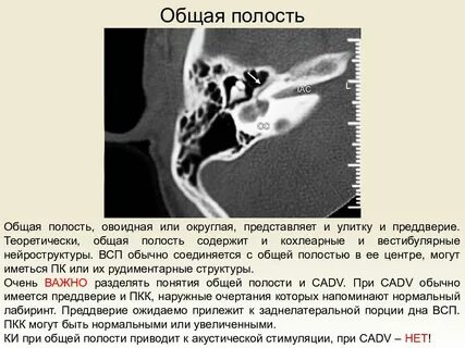 Кт уха