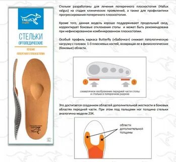 Как подобрать ортопедические стельки взрослому