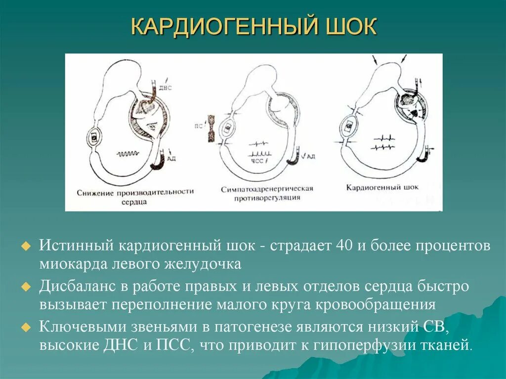 Кардиогенный ШОК. Кардиогенный ШОК сердце. Осложнения кардиогенного шока. Кардиогенный ШОК патогенез. Кардиогенный шок наиболее часто