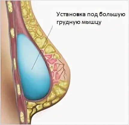 Под мышцу