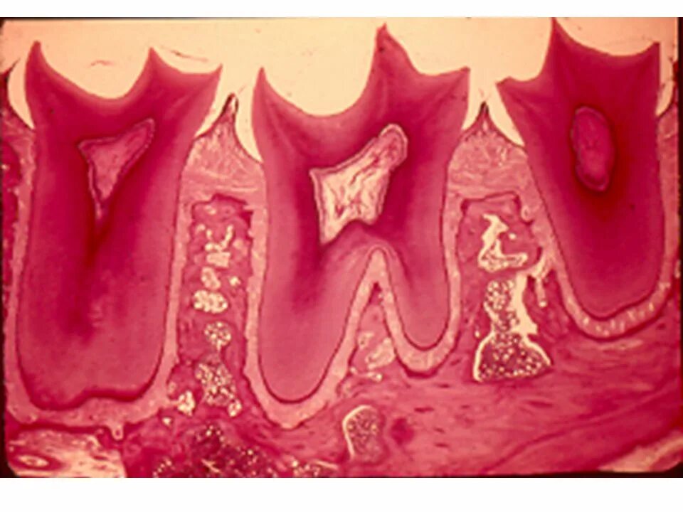 Дентин пульпа гистология. Периодонт гистология препарат. Препарат зуба гистология периодонт. Дентин препарат гистология. Развитие зубов у человека
