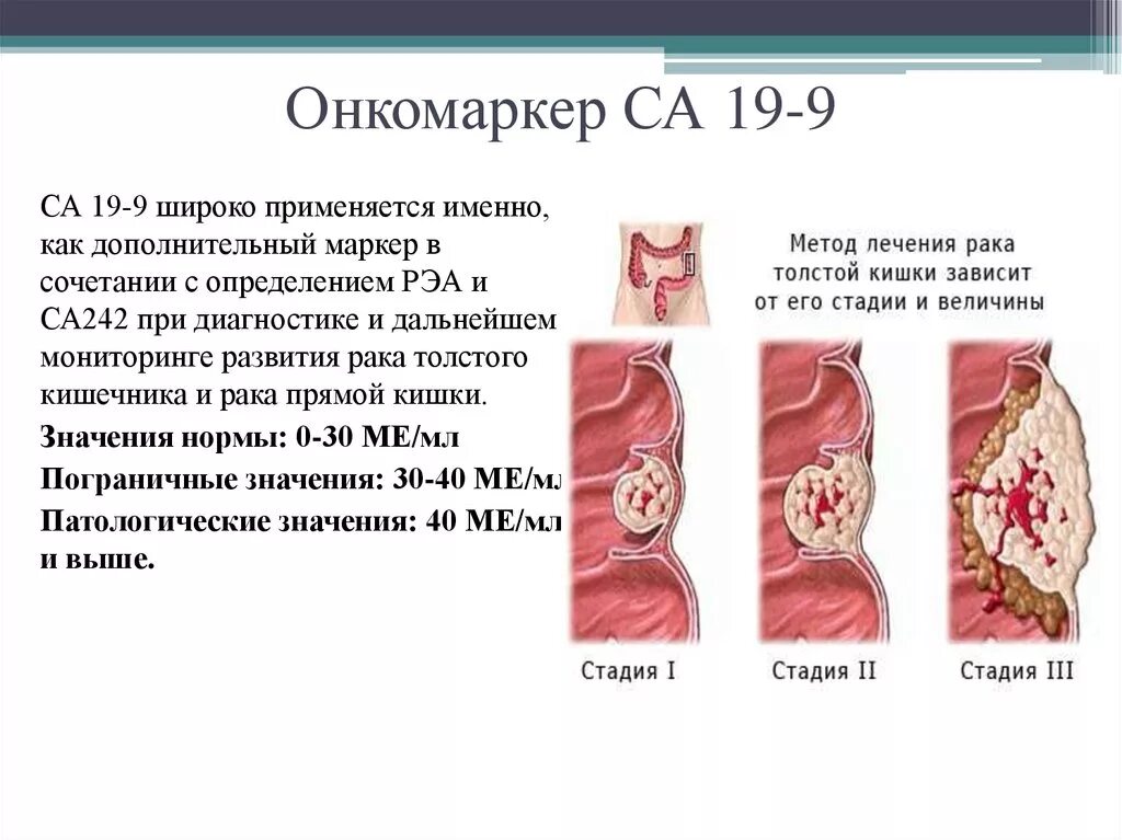 Показатели опухолевого маркера са-19-9. Анализ крови са 19-9 норма. Са19-9 онкомаркеры. Опухолевый маркер са 19-9. Онкомаркер 7