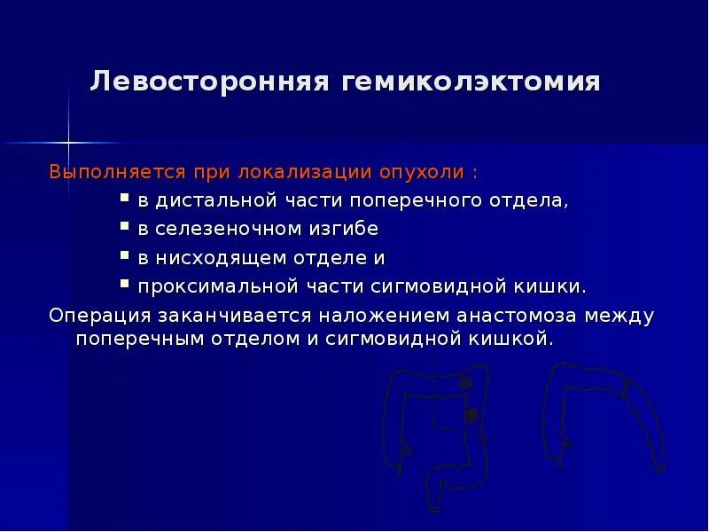 Операция левосторонняя гемиколэктомия. Операция левосторонняя гемиколэктомия. Гемиколэктомия оперативная хирургия. Правосторонняя гемикололэтомия. Операция левосторонняя гемиколэктомия.