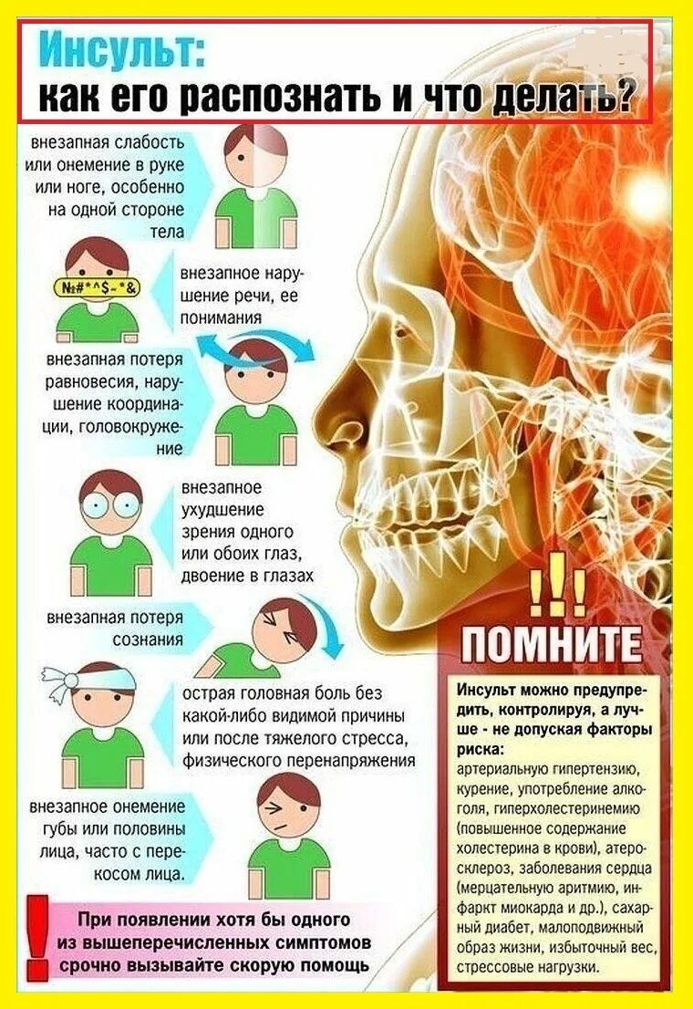 Как вызвать инсульт. Памятка инсульт. Симптомы инсульта памятка. Инсульт симптомы профилактика. Инсульт и его профилактика.