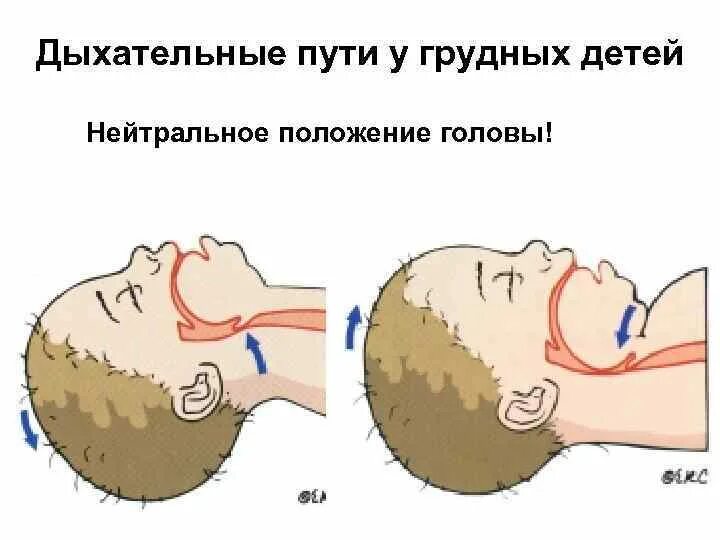 Положение затылка. Нейтральное положение головы. Положение головы в медицине. Нейтральное положение головы у ребенка. Положение головы для дыхательных путей.