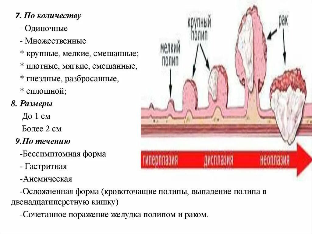 Классификация полипов. Парижская классификация полипов желудка. Диета после операции удаление полипов