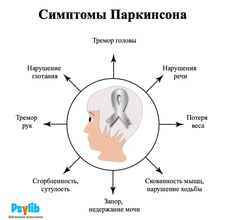 Болезнь раннего. Болезнь паркинсона симптомы. болезнь паркинсона этапы симптомы. 1 признаки паркинсона. причины развития болезни паркинсона.