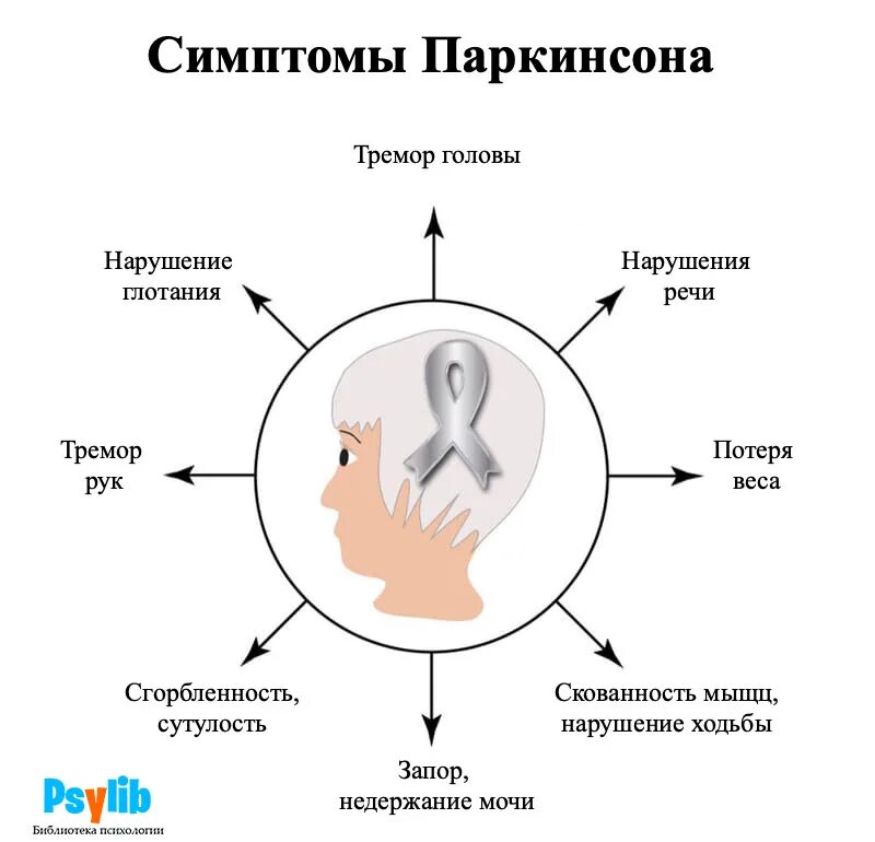 Болезнь Паркинсона симптомы. Болезнь Паркинсона этапы симптомы. 1 Признаки Паркинсона. Причины развития болезни Паркинсона. Что такое болезнь паркинсона простыми словами симптомы