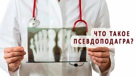 Специалист лечащий подагру