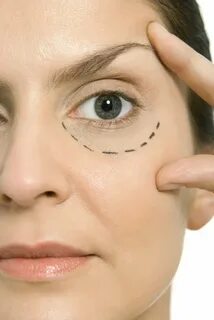 The skin around the eyes
