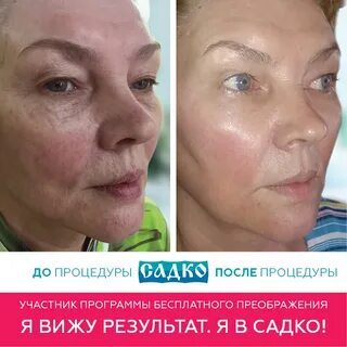 Отзыв о процедуре косметолога