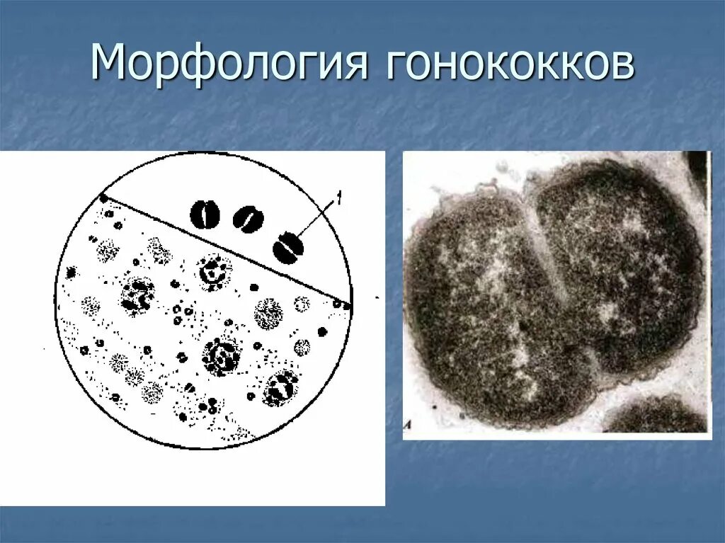 Диплококки что означает