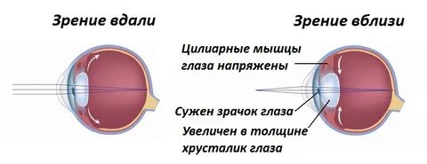 Меняется зрение
