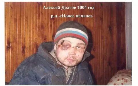 Леха беспалый