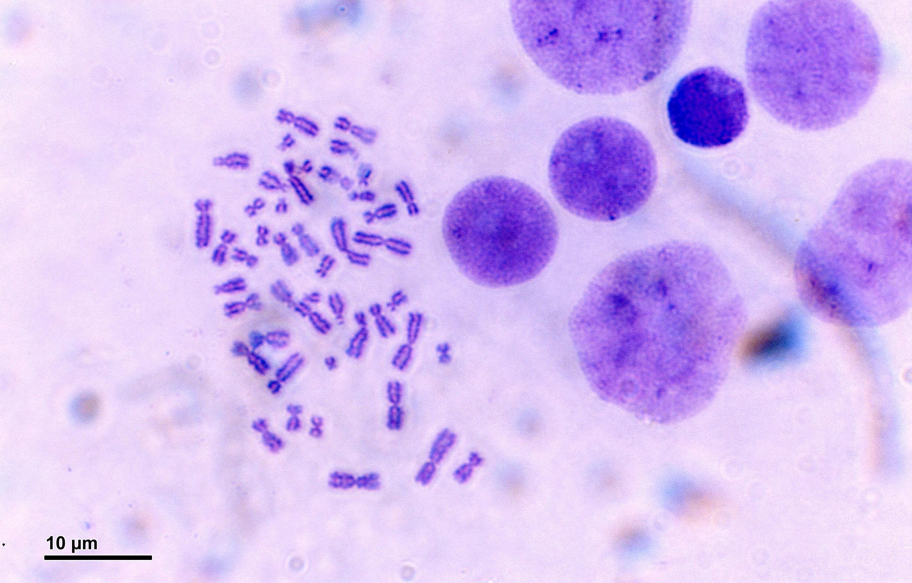 Metaphase Of Mitosis Under Microscope : How to Identify Stages of Mitosis Within
