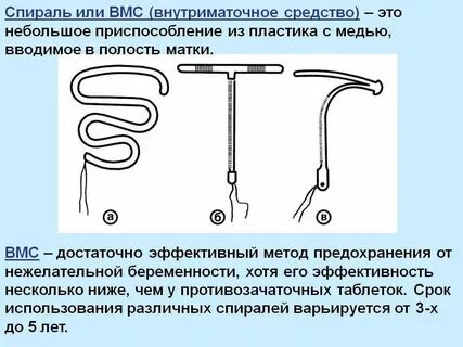 Миома после спирали