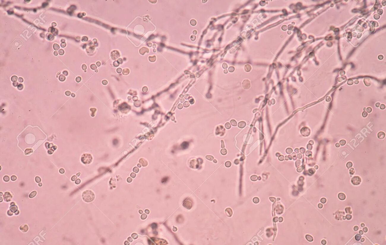 Дрожжевые клетки в моче повышены. Saccharomyces cerevisiae в мазке. Дрожжеподобные клетки в соскобе. Дрожжи микроскоп. Дрожжеподобные клетки гистология.