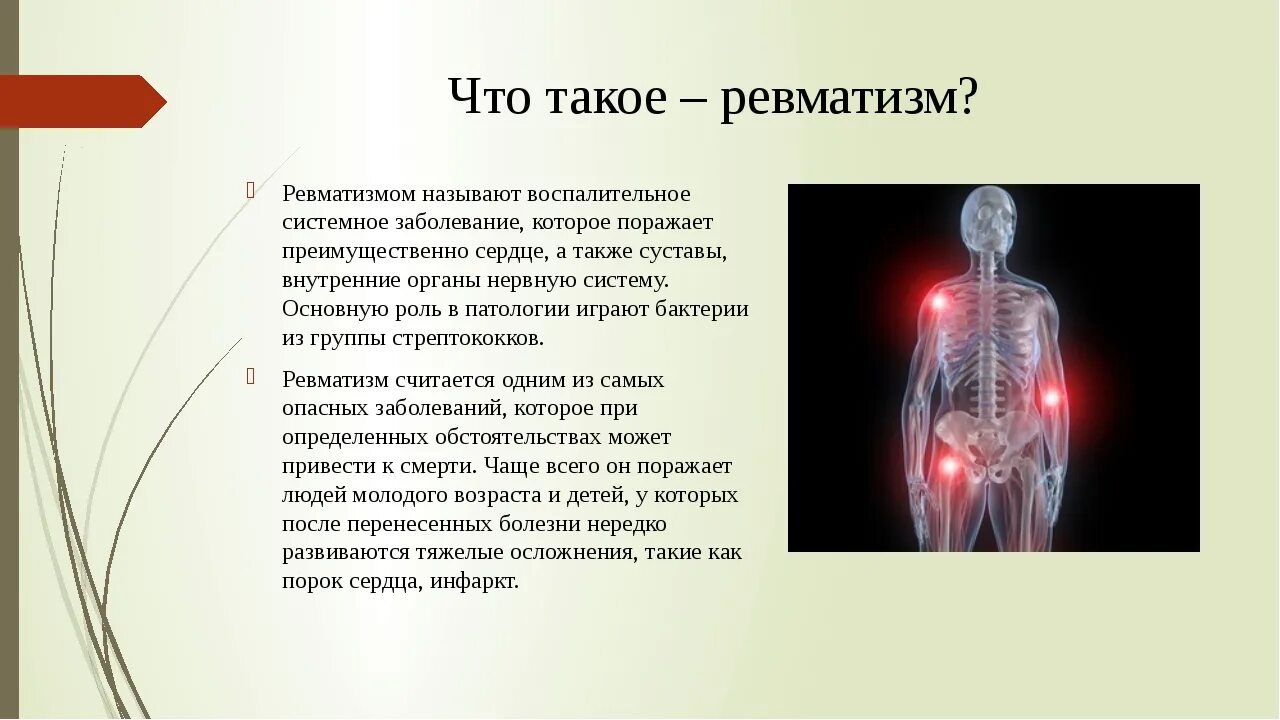 Ревматизм суставной формы. Ревматические заболевания что это такое симптомы. Симптомы суставного ревматизма.