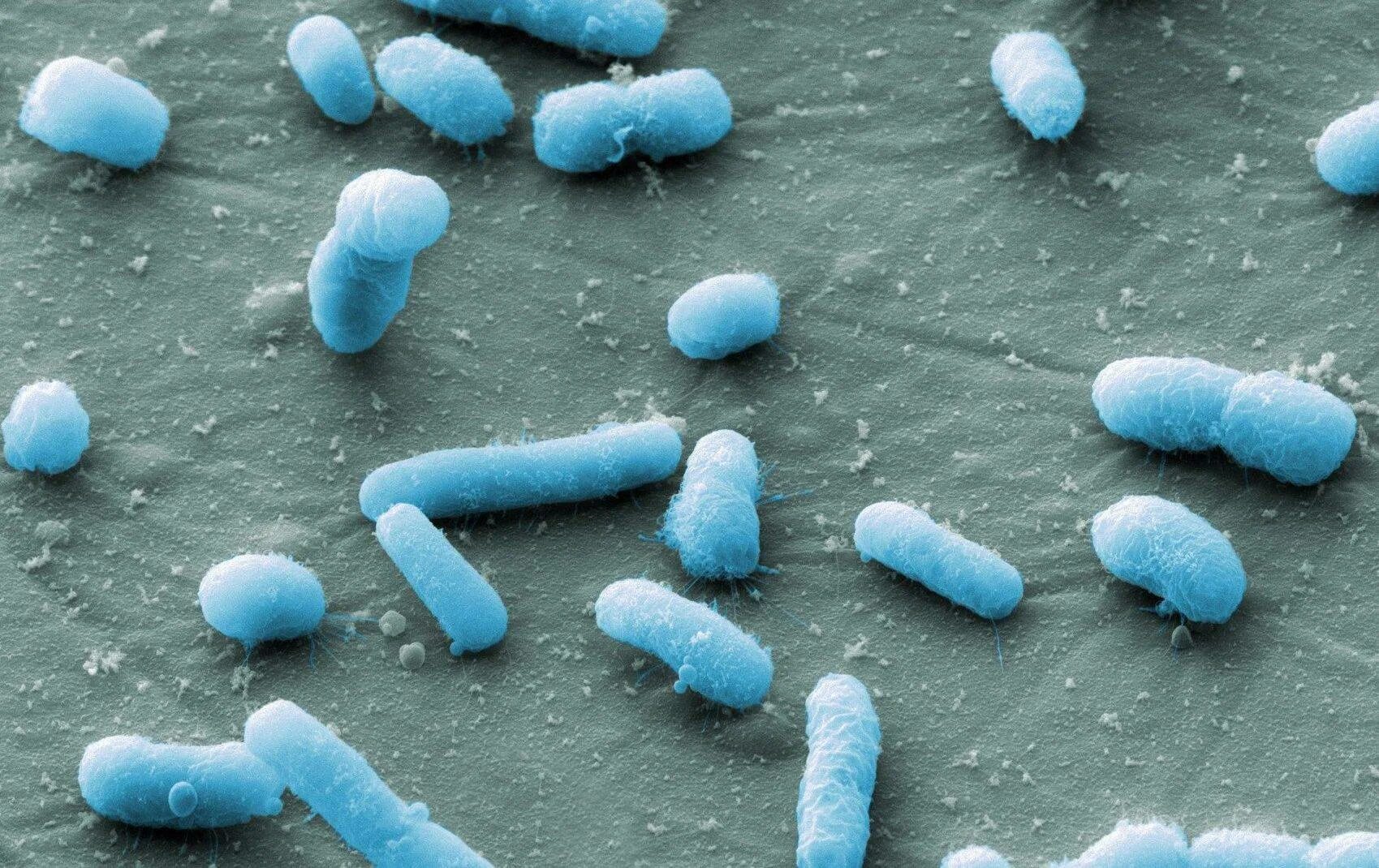 Кишечные палочки какая группа. Бактерия Escherichia coli. О микроорганизмы Escherichia coli. Кишечная палочка Escherichia coli. Эшерихии кишечная палочка.