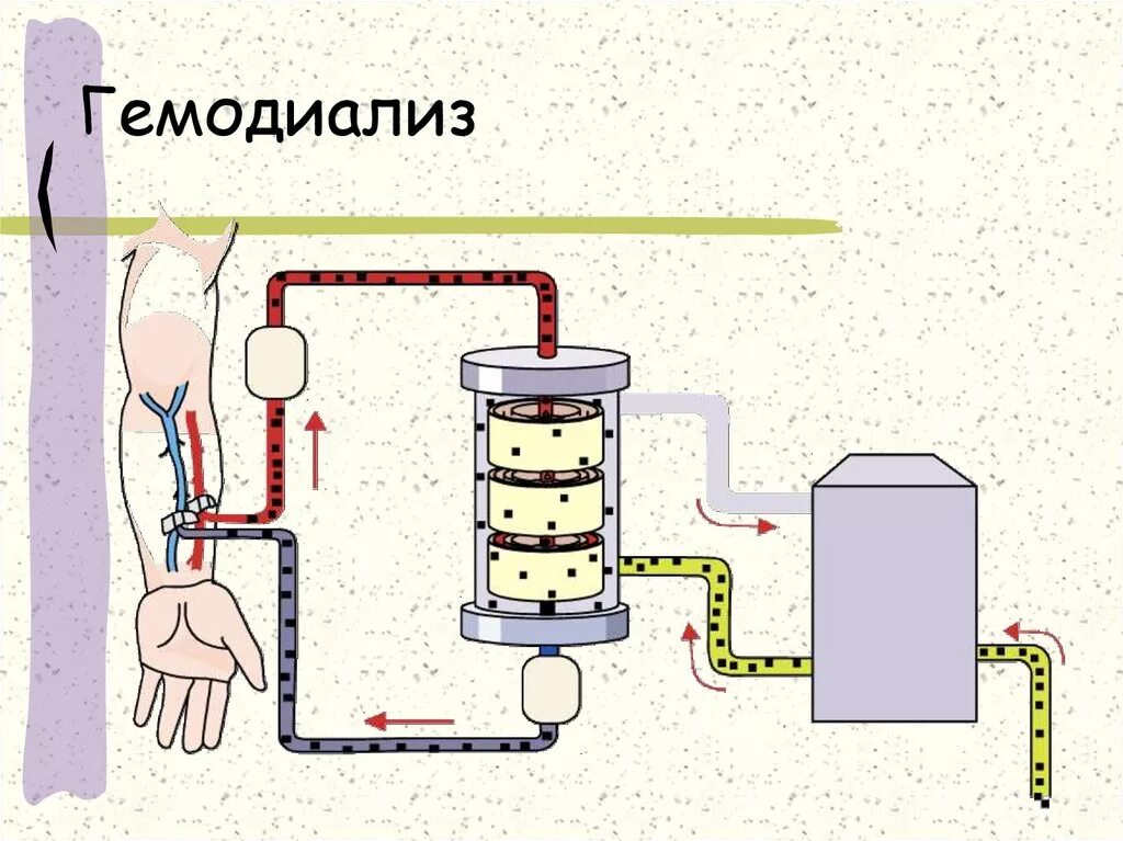 Диализ белков. Аппарат для гемодиализа схема. Диализ схема проведения. Схема гемодиализного аппарата. Диазиз схема.