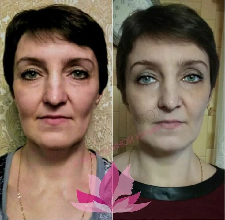 Face Rejuvenation Gymnastics To Raise Flabby Face Skin And Remove Face Wrinkles 