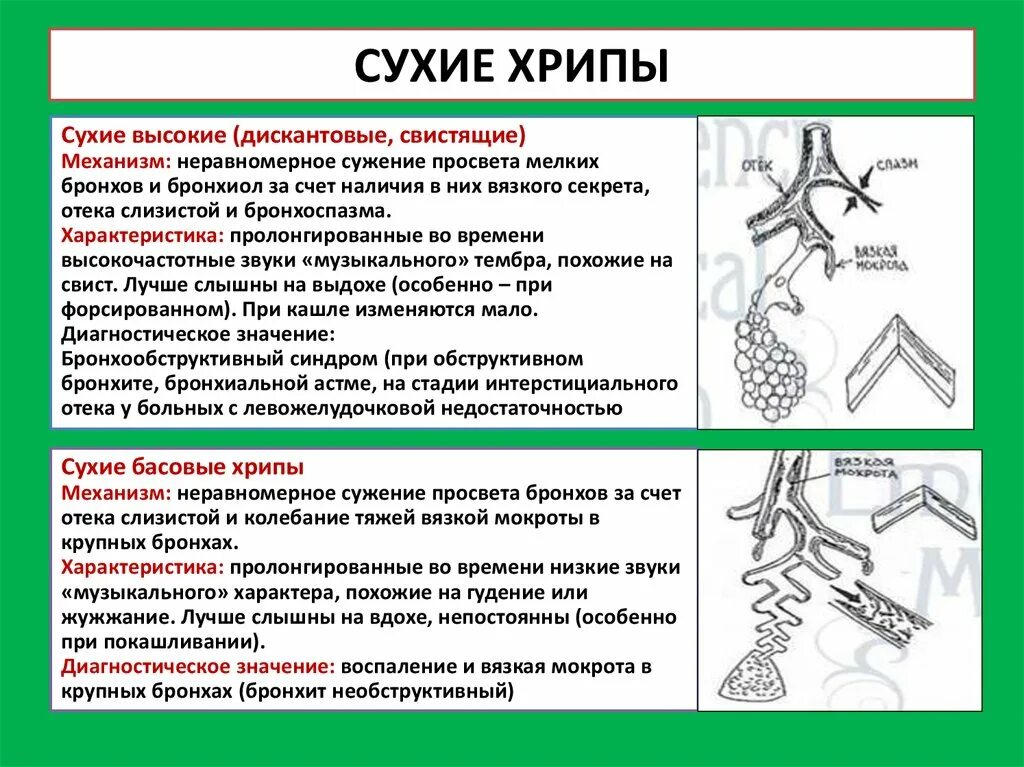 Хрипы в легких звук