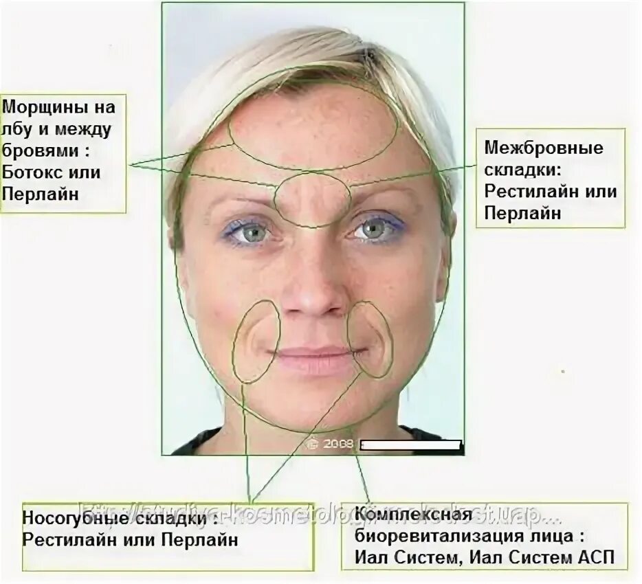Схемы ботулотоксины