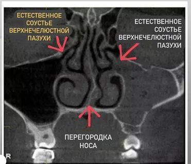 Соустье это