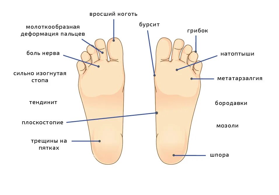 о чем говорят ступни ног. стопа рефлексогенные зоны рисунок. солнечное сплетение рефлекса на стопе. о чем говорят ступни ног. тайский массаж стоп рефлекторные зоны.