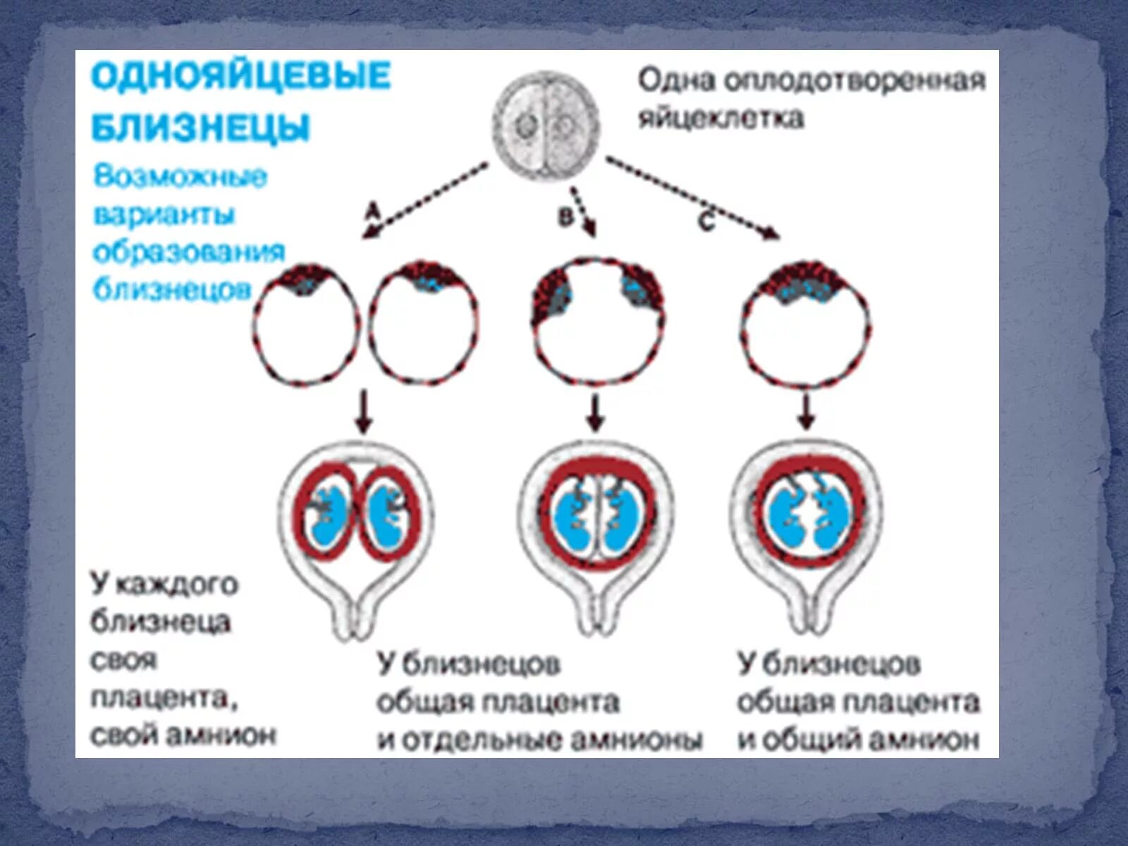 Однояйцевые близнецы пол. Однояйцевые монозиготные Близнецы схема. Схема образования однояйцевых и разнояйцевых близнецов. Варианты развития однояйцевых близнецов. Однояйцевые Близнецы деление яйцеклетки.