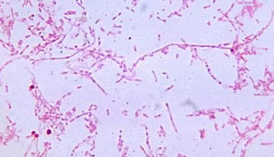 Fusobacterium spp