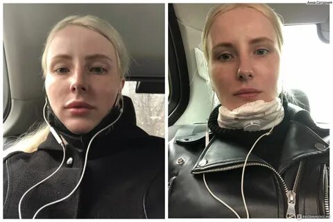 Операция убрать малярные мешки