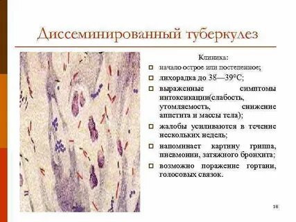 Хронический туберкулез лечение