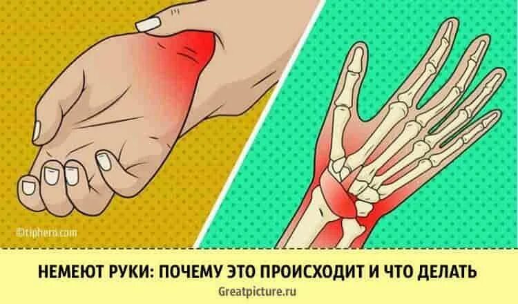 Онимели или онемели