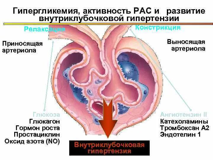 Выносящая артериола почки. Внутриклубочковая гипертензия. Почечная гипергликемии. Ангиотензин 2 выносящая артериола. Выносящая артериола сужение.