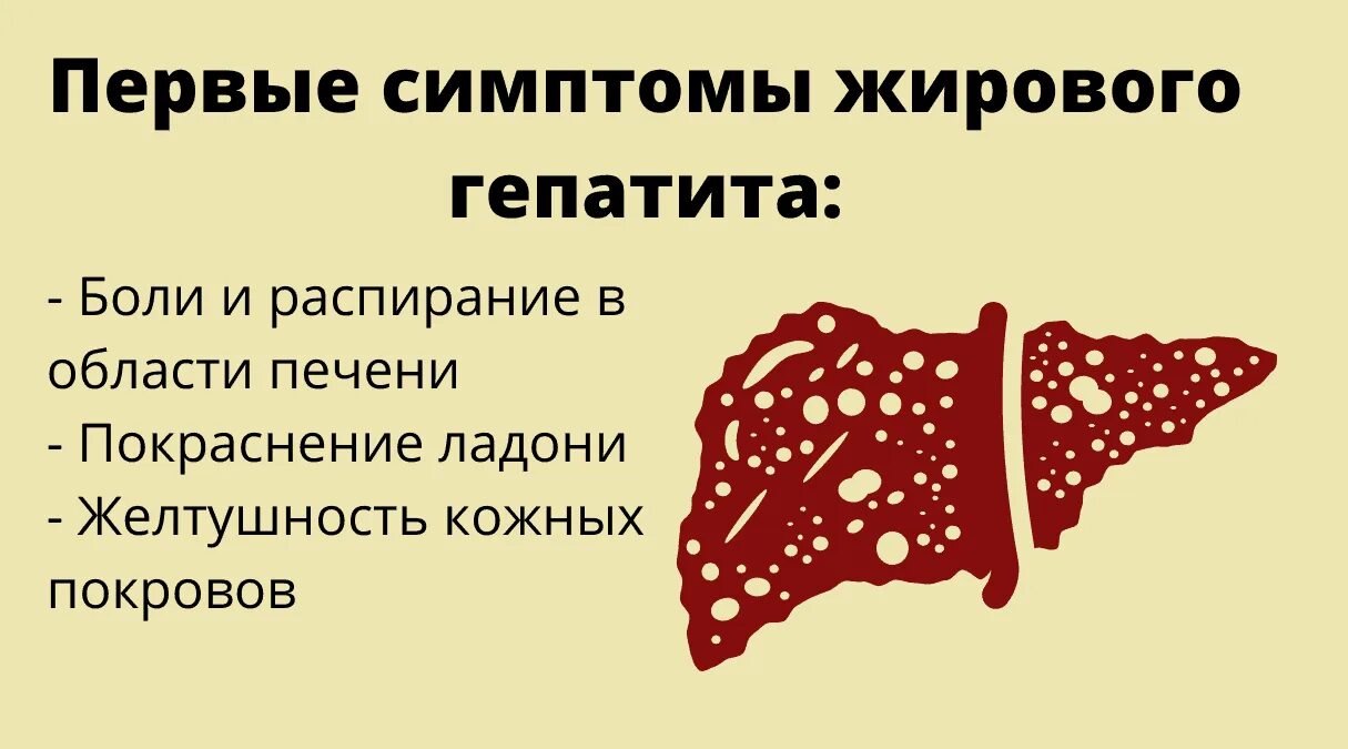 Можно вылечить жировую печень. Жировой гепатоз печени симптомы. Жировой гепатоз симптомы.